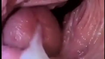 Câmera dentro da vagina mostrando horaquea mulher gosa