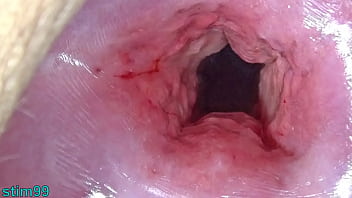 Overlimitted stretching cervix openings and forcedfucking